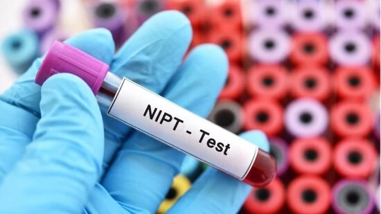 NIPT Test